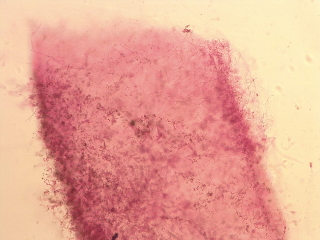 Penicillium Slides - Penicillium 02 100X